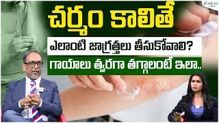 Burn Treatment & Prevention Tips for Families | First Aid for Burns | Dr. Rajesh | Sakshi Life