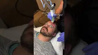 Red Carpet Facial 🤩✨ When you bundle ClearSilk laser & DiamondGlow facial you get result that shine