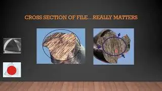 DESIGN OF ROTARY FILE | DECODING DENTISTRY