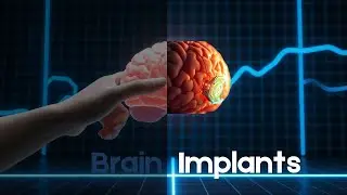 Unlocking Your Brain's Hidden Potential With Neural Implants