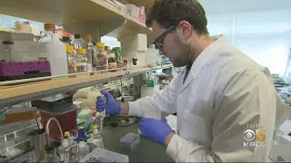Bay Area Patients Stung by Unapproved Stem Cell Treatments