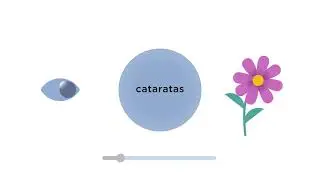 Cataract Surgery: Fixed vs. Adjustable Lenses - Spanish subtitles