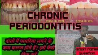 chronic periodontitis lecture