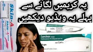 Every Girl Must Know Before Using Skin Creams|| Pigmentation Focused Weekly Skincare Plan