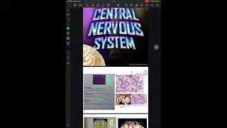 Cns pathology ospe
