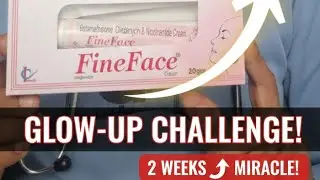 ACNE CURE?! FineFace Cream Review: Get Clear Skin FAST! ACNE का इलाज?  पाएं साफ़ और बेदाग़ त्वचा!