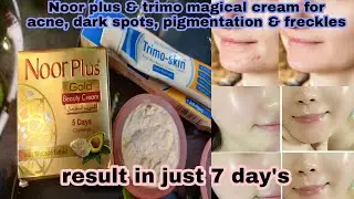 Trimo skin | trimo skin review |Noor cream | Noor gold beauty cream |su beauty and remedies| melasma