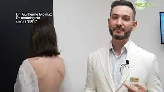 O diagnóstico do Melanoma - Mapeamento corporal (Fotofinder)