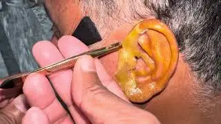ASMR Deep Ear Cleaning 🔥 Ultimate Relaxation &ndash; No Talking, Just Calm Sounds | Part 36🥵