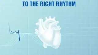 Atrial fibrillation