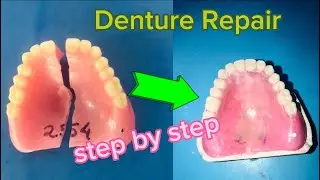 Fractured denture repair/Step by step full procedure/ prosthodontics/ WRINKLER/Pre-clininical/INTERN
