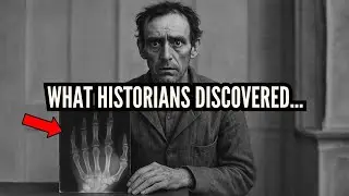 1897 X-Ray of a Patient's Hand Looked Normal &mdash; Until Doctors Counted the Bones Inside.