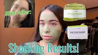 Teami Green Tea Detox Mask (Before & After) Better Skin In One Use?