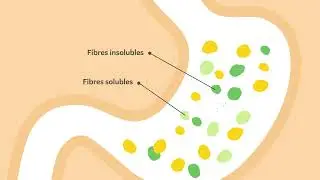 Viata XLS Medical Fat Reducer