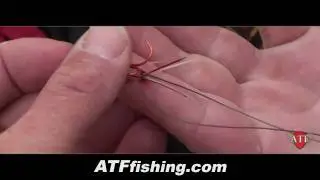 How To Remove A Hook From Finger (REAL FOOTAGE!)