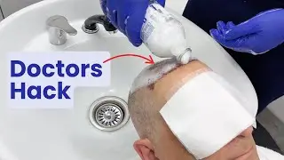 Post Hair Transplant Hair Wash Guide (DIY) | Dr Shaan Royal Wharf Clinic