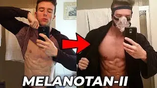 Melanotan II PERMANENTLY Darkened My Skin!