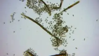 L  salmonis Egg string time lapse over 20h