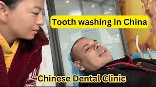 Teeth cleaning in China || New technology in Dental Clinic and all these facts #vlog