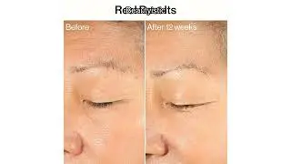 Обзор сыворотки Honest Beauty Ageless Firm & Even: помогает ли веганский коллаген?