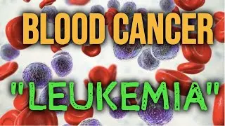 BLOOD CANCER||LEUKEMIA||Explained #leukemia #bloodcancer #health