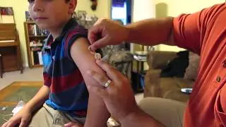 Medtronic Enlite Sensor Insertion WITHOUT Enlite Serter Device