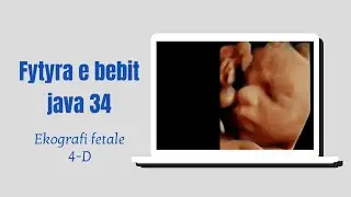 Eko fetale 3D / 4D java 34 (Fetal face at 34 wks of pregnancy)