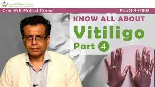 Side effects & Cost Vitiligo Surgery/Melanocyte Transplantation in Delhi | Care Well Medical Centre