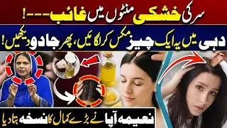 Home Remedies for Dandruff | Natural Dandruff Removal Hack | City 41