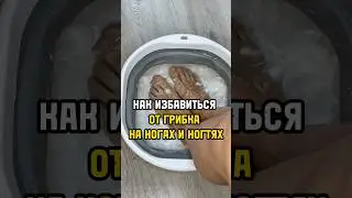 Грибок ногтей на ногах лечение в домашних условиях.