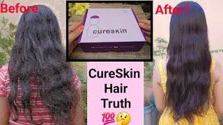 CureSkin Hair Kit Honest Review💯 | Is CureSkin Worth It?🤔 My CureSkin Hair Journey✨️Glow Yourself💕