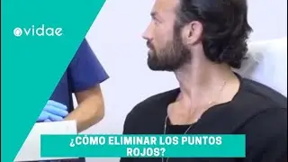&iquest;C&oacute;mo eliminar los puntos rojos?