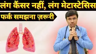 लंग कैंसर नहीं, लंग मेटास्टेसिस: फर्क समझना ज़रूरी / Lung Metastases Explained