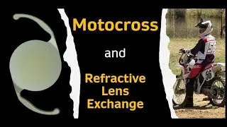 Action Sports after Eye Surgery (Refractive Lens Exchange with PanOptix Pro) - Game Changer?!?