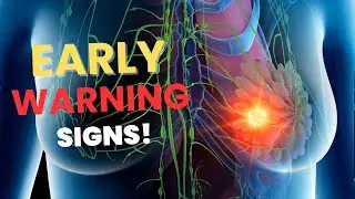 Breast Cancer Warning Signs You Should NEVER Ignore. #BreastCancer #CancerAwareness #EarlyDetection
