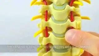 Injuries that Contribute to Neck Pain - Physical Therapy, Sterling, VA