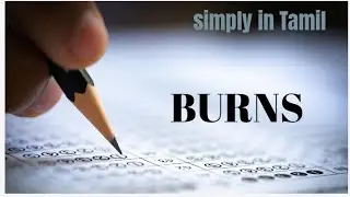 BURNS | Management and complications | Clever explanation in Tamil