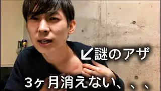 【注意喚起】無職、皮膚がんの疑いあり病院へ行く