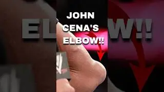 What happened after John Cena injured his elbow #wwe #johncena