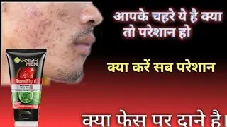 Grnier men Acno Fight Aapko Gora Kar Dega Facewash
