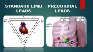Basic of ECG