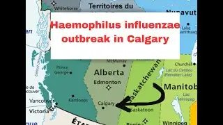 Canada: Haemophilus influenzae type B outbreak in Calgary