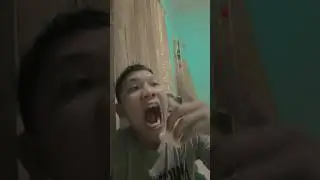 I almost lost my finger 😭 #memes #trending #mukbang #subscribe #shorts