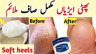 Winter Skin Whitening with Vaseline | Face, Hands & Feet Care | Manicure Pedicure At Home #softhands