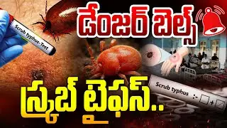 స్క్రబ్ టైఫస్.. డేంజర్ బెల్స్ | Scrub Typhus Cases Increasing in Andhra Pradesh | iNews