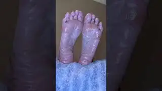 Spread Toes and Wrinkled Soles Jan 2023