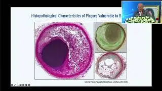 PROF.M.VISWANATHAN GOLD MEDAL ORATION - Prof  Jagat Narula