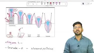 Uterine prolapse // obstetrics and gynaecology// by pc saini