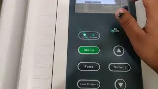 MR 900 ECG Machine