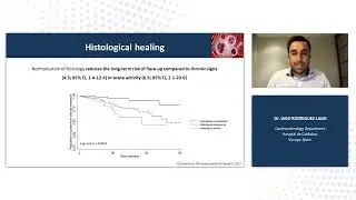 02  Does the ideal target in UC treatment exist